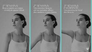Infografico movimentação dos braços - colocar silicone - mamoplastia de aumento