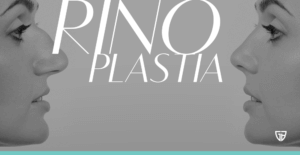 rinoplastia